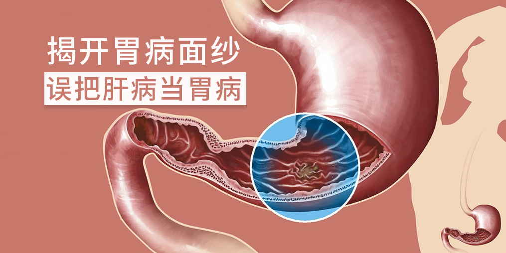 警惕“假胃病”，小心是肝有問(wèn)題
